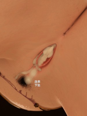 [不如相忘] 危城 1-3_236